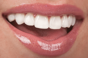 Woman's smiling mouth